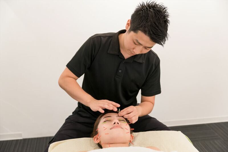 美容鍼を行うスタッフ